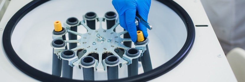 工業堿式碳酸鋅檢測